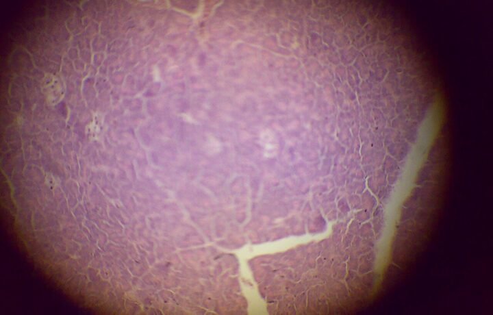 Microfotografía de tejido pancreático. Imagen histológica ilustrativa; no identifica un diagnóstico de cáncer ni un paciente del programa provincial.