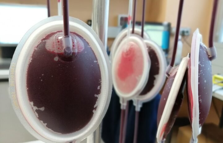Bolsas de sangre en el hospital Santi Antonio e Biagio e Cesare Arrigo, Italia. Fotografía ilustrativa de hemoterapia.